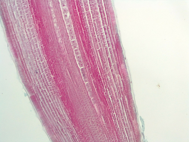 Dicot Root LS Slides - Dicot Root LS 02 100X